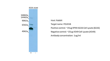 POLR1B Rabbit Polyclonal Antibody