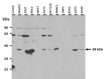 NSUN3 Rabbit Polyclonal Antibody