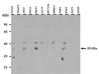 NSUN3 Rabbit Polyclonal Antibody