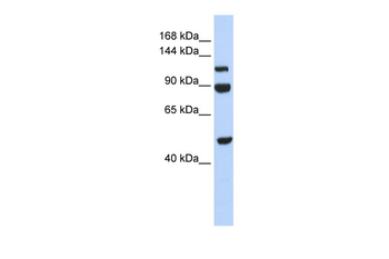 NARG1L Rabbit Polyclonal Antibody