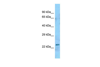 ART5 Rabbit Polyclonal Antibody
