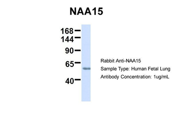 NARG1 Rabbit Polyclonal Antibody