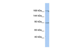 NARG1 Rabbit Polyclonal Antibody