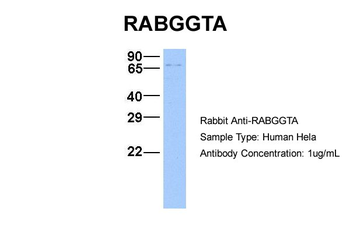 RABGGTA Rabbit Polyclonal Antibody