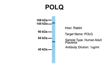 POLQ Rabbit Polyclonal Antibody