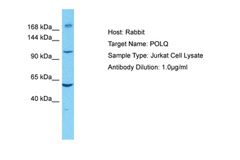 POLQ Rabbit Polyclonal Antibody
