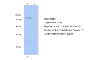 POLQ Rabbit Polyclonal Antibody