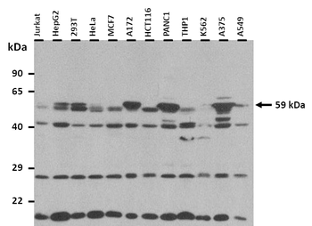 Uap1 Rabbit Polyclonal Antibody