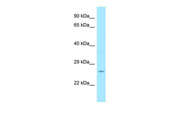 GSTT4 Rabbit Polyclonal Antibody