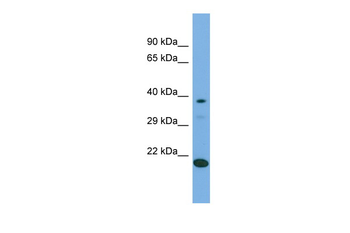 LIPT2 Rabbit Polyclonal Antibody