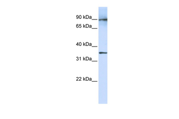 LRRC59 Rabbit Polyclonal Antibody