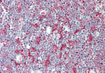 SMPD3 Rabbit Polyclonal Antibody