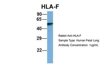 HLA-F Rabbit Polyclonal Antibody