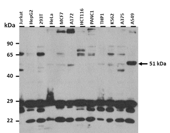 MIEF1 Rabbit Polyclonal Antibody