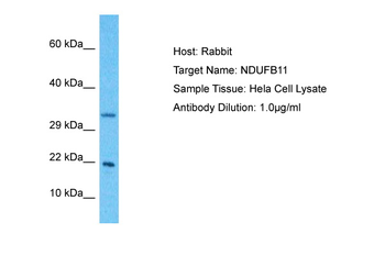 NDUFB11 Rabbit Polyclonal Antibody