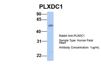 PLXDC1 Rabbit Polyclonal Antibody