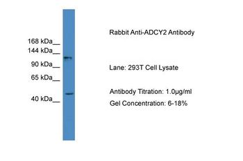 ADCY2 Rabbit Polyclonal Antibody