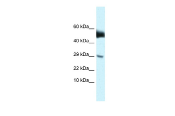 Amhr2 Rabbit Polyclonal Antibody