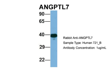 ANGPTL7 Rabbit Polyclonal Antibody