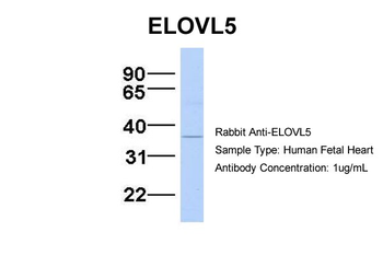 ELOVL5 Rabbit Polyclonal Antibody
