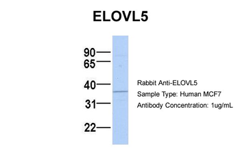 ELOVL5 Rabbit Polyclonal Antibody