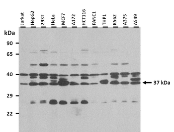 TNMD Rabbit Polyclonal Antibody