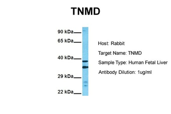 TNMD Rabbit Polyclonal Antibody