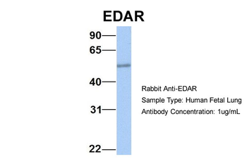 EDAR Rabbit Polyclonal Antibody