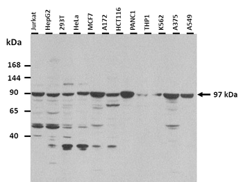 RHBDF1 Rabbit Polyclonal Antibody
