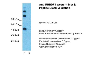 RHBDF1 Rabbit Polyclonal Antibody