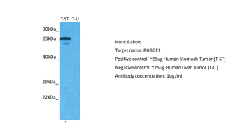 RHBDF1 Rabbit Polyclonal Antibody