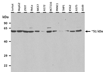 PORCN Rabbit Polyclonal Antibody
