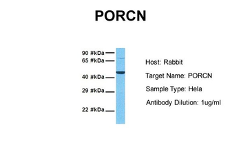 PORCN Rabbit Polyclonal Antibody