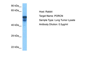 PORCN Rabbit Polyclonal Antibody