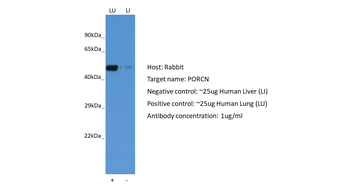 PORCN Rabbit Polyclonal Antibody