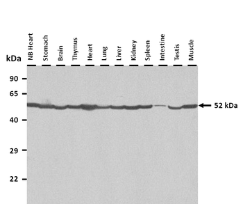 Porcn Rabbit Polyclonal Antibody
