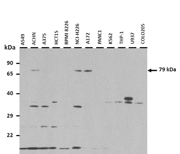 ACSL4 Rabbit Polyclonal Antibody