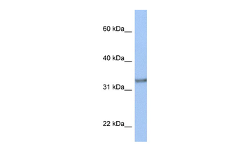 ACBD4 Rabbit Polyclonal Antibody