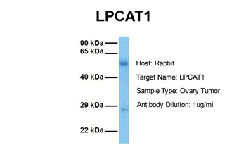 LPCAT1 Rabbit Polyclonal Antibody