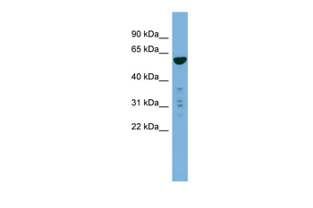 PTDSS2 Rabbit Polyclonal Antibody
