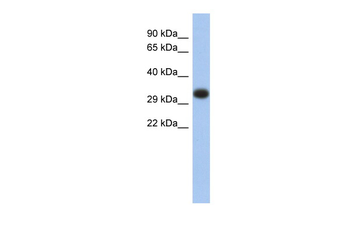 HLA-DPA1 Rabbit Polyclonal Antibody