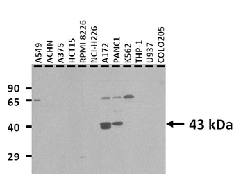 CYTB Rabbit Polyclonal Antibody