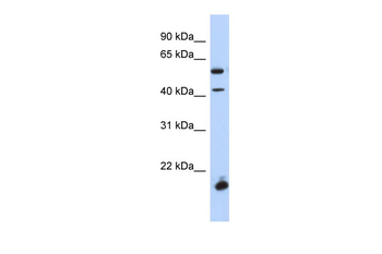 DBX1 Rabbit Polyclonal Antibody