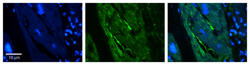 RB1CC1 Rabbit Polyclonal Antibody