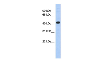 UBA3 Rabbit Polyclonal Antibody