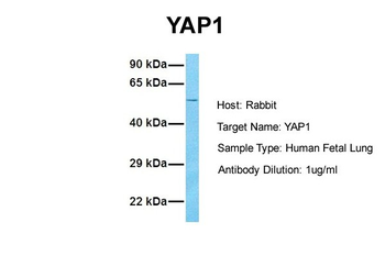 YAP1 Rabbit Polyclonal Antibody