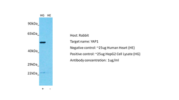 YAP1 Rabbit Polyclonal Antibody