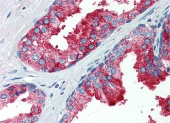 YAP1 Rabbit Polyclonal Antibody