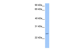 PTTG2 Rabbit Polyclonal Antibody