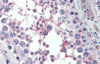MED4 Rabbit Polyclonal Antibody